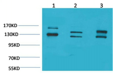 Fig1:; Western blot analysis of 1) 293T, 2)Mouse Brain Tissue, 3) Rat Brain Tissue with BAI1 Rabbit pAb diluted at 1:2,000.