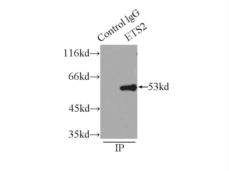 IP Result of anti-ETS2 (IP:Catalog No:110487, 3ug; Detection:Catalog No:110487 1:600) with HeLa cells lysate 5000ug.