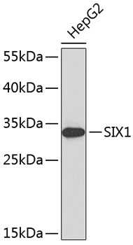 Western blot - SIX1 Polyclonal Antibody 