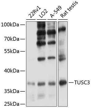 Western blot - TUSC3 Polyclonal Antibody 