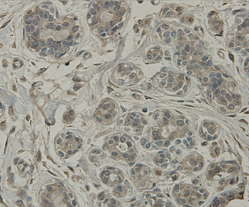 Fig8: Immunohistochemical analysis of paraffin-embedded human breast tissue using anti-C19orf35 antibody. Counter stained with hematoxylin.