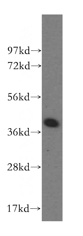 human liver tissue were subjected to SDS PAGE followed by western blot with Catalog No:110139(DYNC2LI1 antibody) at dilution of 1:500