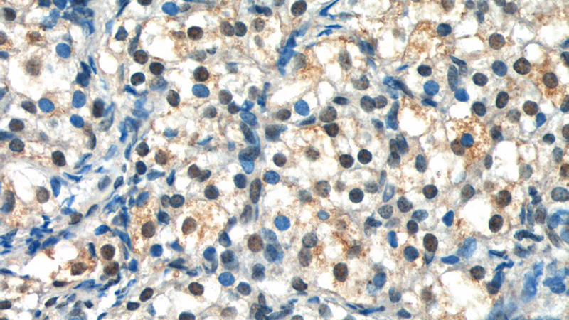 Immunohistochemistry of paraffin-embedded human ovary tissue slide using Catalog No:113280(NRIP3 Antibody) at dilution of 1:50 (under 40x lens)