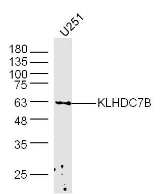 Fig1: Sample: U251 (human)cell Lysate at 40 ug; Primary: Anti-KLHDC7B at 1/300 dilution; Secondary: IRDye800CW Goat Anti-Rabbit IgG at 1/20000 dilution; Predicted band size: 63 kD; Observed band size: 63 kD