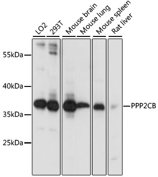 Western blot - PPP2CB Polyclonal Antibody 