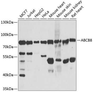 Western blot - ABCB8 Polyclonal Antibody 