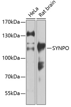 Western blot - SYNPO Polyclonal Antibody 