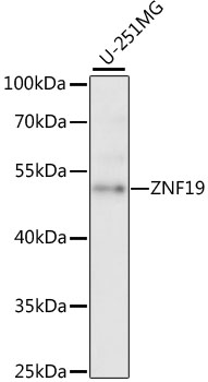 Western blot - ZNF19 Polyclonal Antibody 