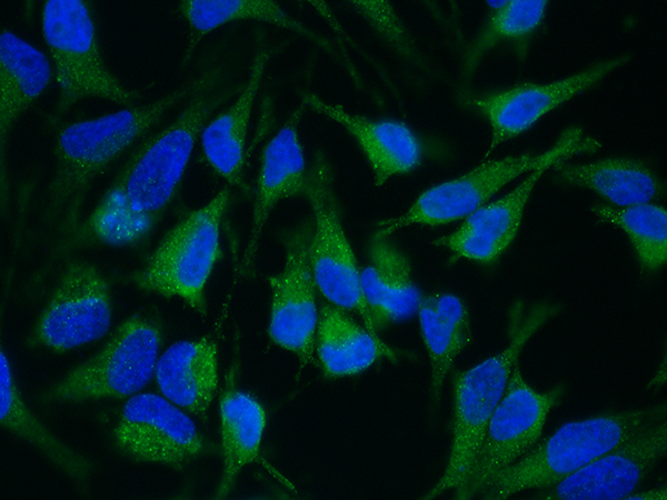 ADAM15 / MDC15 Antibody, Rabbit MAb, Immunofluorescence