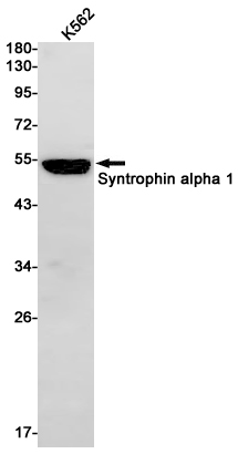 Western blot detection of Syntrophin alpha 1 in K562 cell lysates using Syntrophin alpha 1 Rabbit pAb(1:1000 diluted).Predicted band size:54kDa.Observed band size:54kDa.