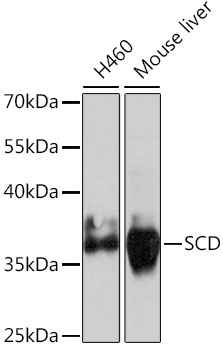 Western blot - SCD Polyclonal Antibody 