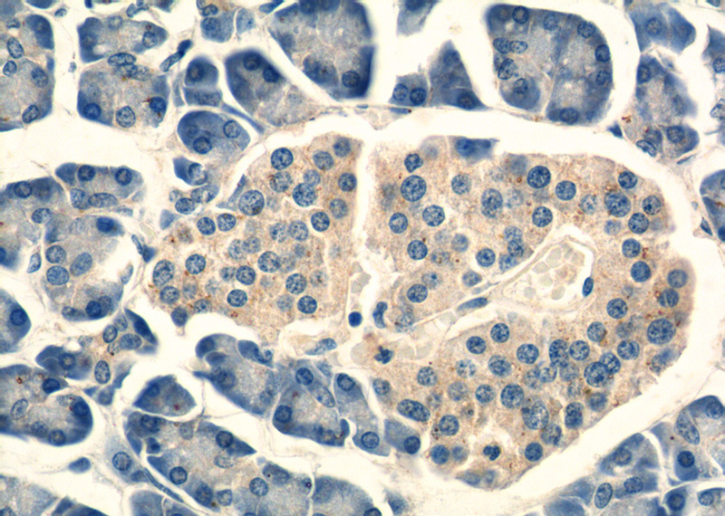 Immunohistochemistry of paraffin-embedded human pancreas tissue slide using Catalog No:110916(G-CSF Antibody) at dilution of 1:50 (under 40x lens)