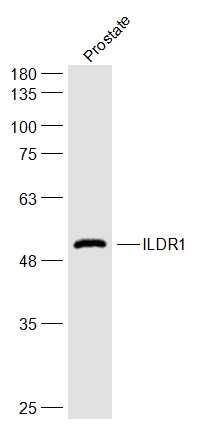 Fig3: Sample:; Prostate(Rat) Cell Lysate at 40 ug; Primary: Anti-ILDR1 at 1/300 dilution; Secondary: IRDye800CW Goat Anti-Rabbit IgG at 1/20000 dilution; Predicted band size: 60 kD; Observed band size: 56 kD