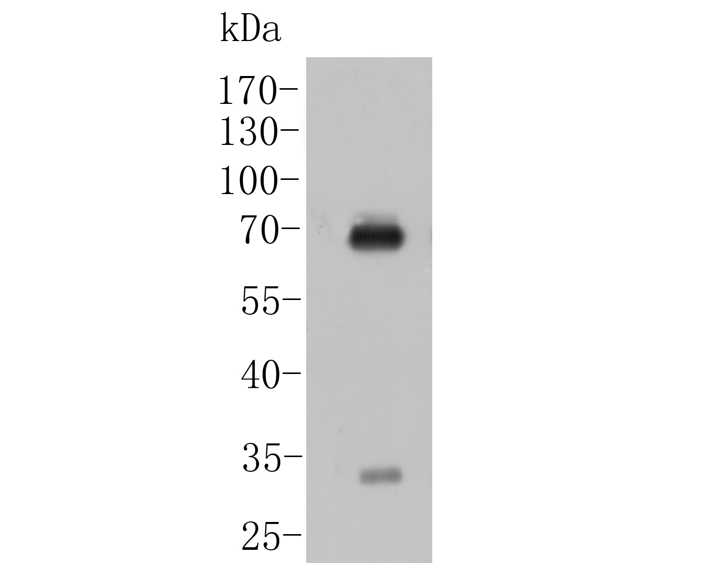 Fig1:; Western blot analysis of IgA on Human plasma tissue lysates. Proteins were transferred to a PVDF membrane and blocked with 5% BSA in PBS for 1 hour at room temperature. The primary antibody ( 1/1000) was used in 5% BSA at room temperature for 2 hours. Goat Anti-Mouse IgG - HRP Secondary Antibody (HA1006) at 1:5,000 dilution was used for 1 hour at room temperature.