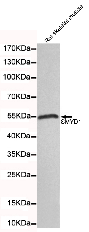 Western blot detection of SMYD1 in rat skeletal muscle lysates and using SMYD1 mouse mAb (1:100 diluted). Predicted band size: 56KDa.Observed band size: 56KDa.