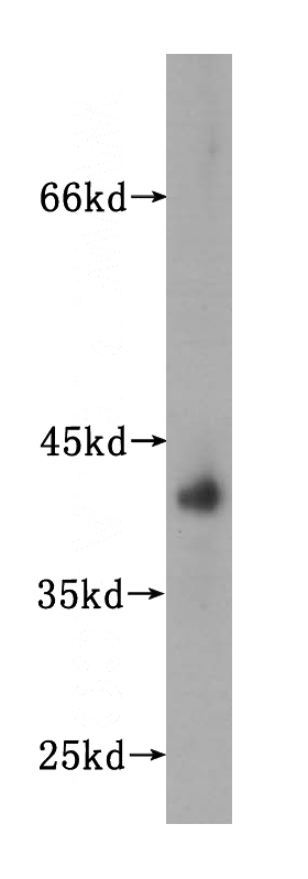 human liver tissue were subjected to SDS PAGE followed by western blot with Catalog No:111546(HSD17B2 antibody) at dilution of 1:400
