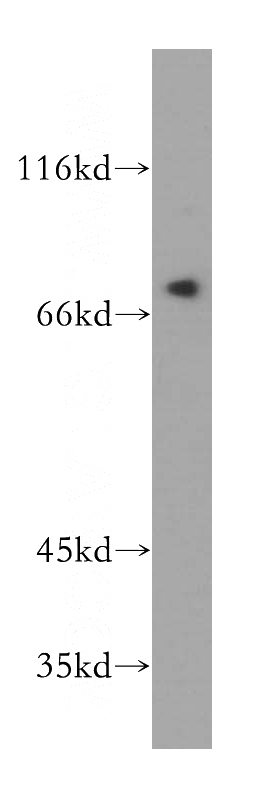 HeLa cells were subjected to SDS PAGE followed by western blot with Catalog No:115053(SAMD4B antibody) at dilution of 1:800