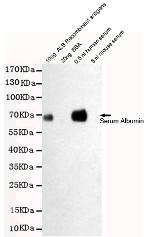 Western blot detection of Human Serum Albumin in 0.5nl human serum and 10ng ALB Recombinant antigens cell lysates using Human Serum Albumin mouse mAb (1:2000 diluted).Predicted band size:67KDa.Observed band size:67KDa.