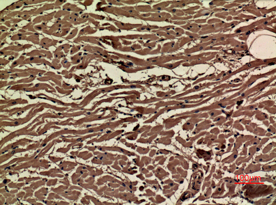 Immunohistochemical analysis of paraffin-embedded human-heart, antibody was diluted at 1:100