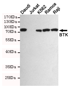 Western blot detection of BTK in Daudi,Jurkat(BTK negative),K562,Ramos and Raji cell lysates using BTK mouse mAb (1:1000 diluted).Predicted band size:77KDa.Observed band size:77KDa.