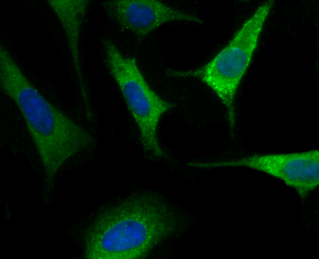 Fig5:; ICC staining of Nogo in SH-SY5Y cells (green). Formalin fixed cells were permeabilized with 0.1% Triton X-100 in TBS for 10 minutes at room temperature and blocked with 10% negative goat serum for 15 minutes at room temperature. Cells were probed with the primary antibody ( 1/50) for 1 hour at room temperature, washed with PBS. Alexa Fluor®488 conjugate-Goat anti-Rabbit IgG was used as the secondary antibody at 1/1,000 dilution. The nuclear counter stain is DAPI (blue).
