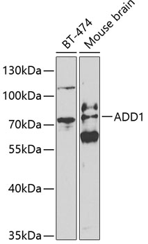 Western blot - ADD1 Polyclonal Antibody 