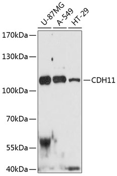 Western blot - CDH11 Polyclonal Antibody 