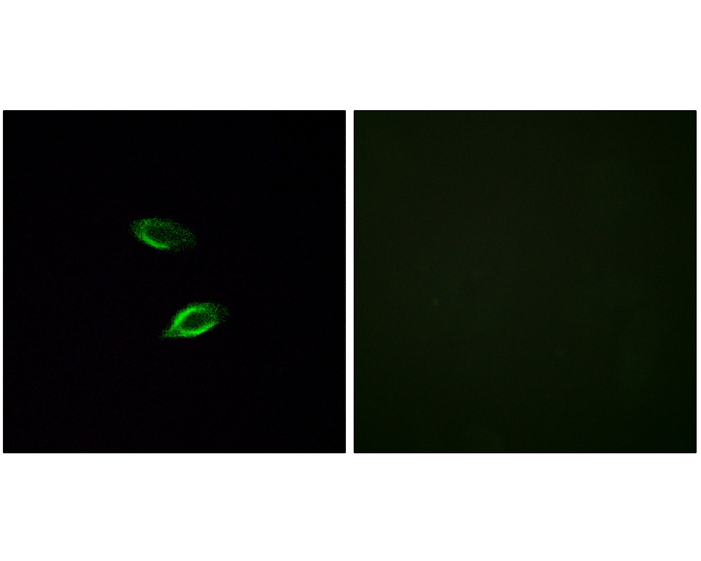 Fig3:; Immunofluorescence analysis of HUVEC cells, using GPR157 Antibody. The picture on the right is blocked with the synthesized peptide.