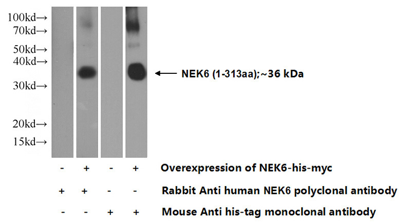 Transfected HEK-293 cells were subjected to SDS PAGE followed by western blot with Catalog No:113105(NEK6 Antibody) at dilution of 1:1000