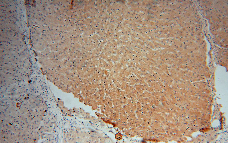 Immunohistochemical of paraffin-embedded human liver using Catalog No:110611(FDXR antibody) at dilution of 1:100 (under 10x lens)
