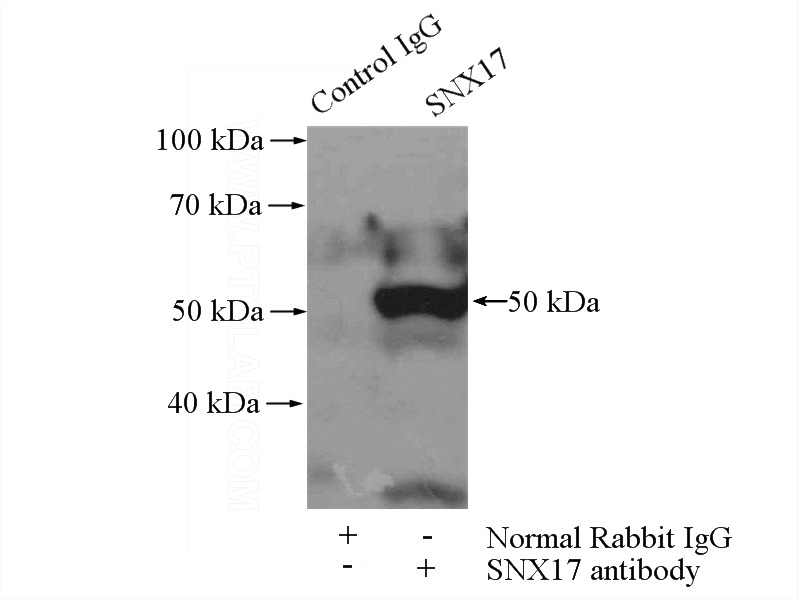 IP Result of anti-SNX17 (IP:Catalog No:115472, 4ug; Detection:Catalog No:115472 1:1000) with HeLa cells lysate 1200ug.