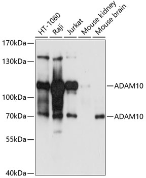 Western blot - ADAM10 Polyclonal Antibody 