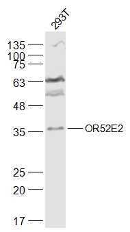 Fig1: Sample:; 293T(Human) Cell Lysate at 30 ug; Primary: Anti-OR52E2 at 1/300 dilution; Secondary: IRDye800CW Goat Anti-Rabbit IgG at 1/20000 dilution; Predicted band size: 37 kD; Observed band size: 37 kD