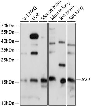 Western blot - AVP Polyclonal Antibody 
