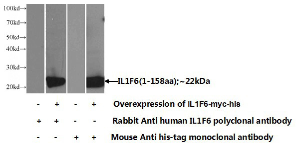 Transfected HEK-293 cells were subjected to SDS PAGE followed by western blot with Catalog No:111770(IL1F6 Antibody) at dilution of 1:1000