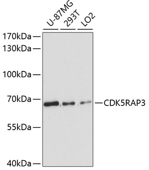 Western blot - CDK5RAP3 Polyclonal Antibody 