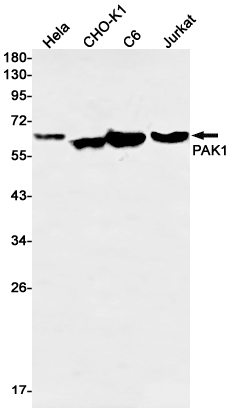 Western blot detection of PAK1 in Hela,CHO-K1,C6,Jurkat cell lysates using PAK1 Rabbit mAb(1:1000 diluted).Predicted band size:61kDa.Observed band size:61kDa.