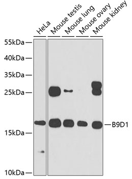 Western blot - B9D1 Polyclonal Antibody 