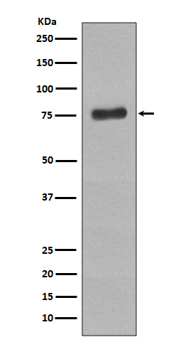 Western blot analysis of Phospho-BTK (Y223) expression in Raji cell lysate treated with pervanadate.