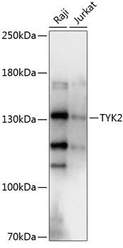 Western blot - TYK2 Polyclonal Antibody 