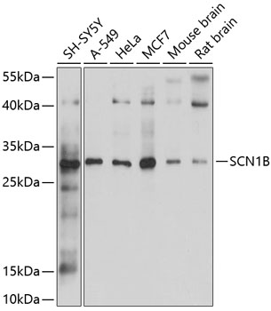 Western blot - SCN1B Polyclonal Antibody 
