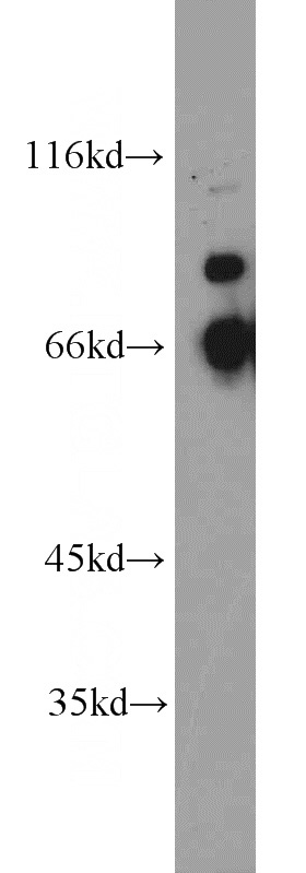 SW 1990 cells were subjected to SDS PAGE followed by western blot with Catalog No:114403(QSOX1 antibody) at dilution of 1:1000