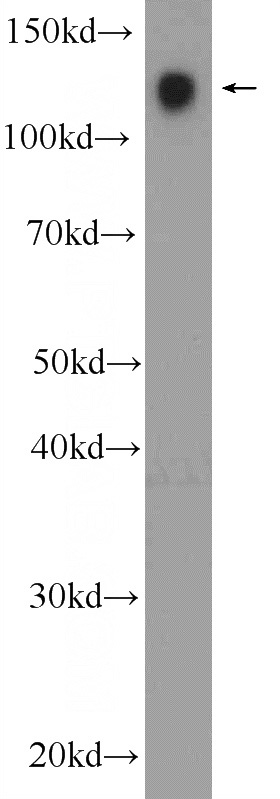 Jurkat cells were subjected to SDS PAGE followed by western blot with Catalog No:109025(CD31 Antibody) at dilution of 1:1000