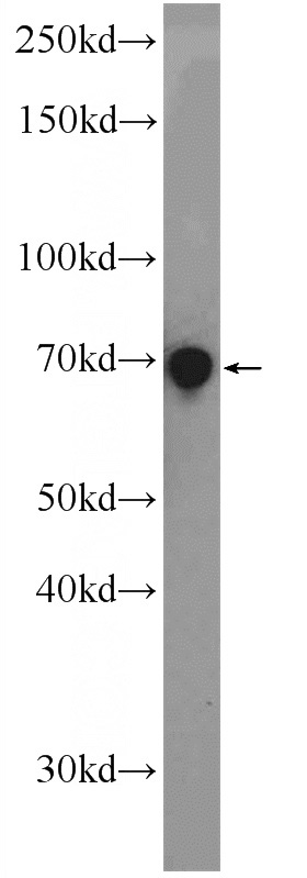 COLO 320 cells were subjected to SDS PAGE followed by western blot with Catalog No:114667(RHPN2 Antibody) at dilution of 1:600