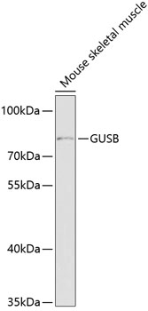 Western blot - GUSB Polyclonal Antibody 