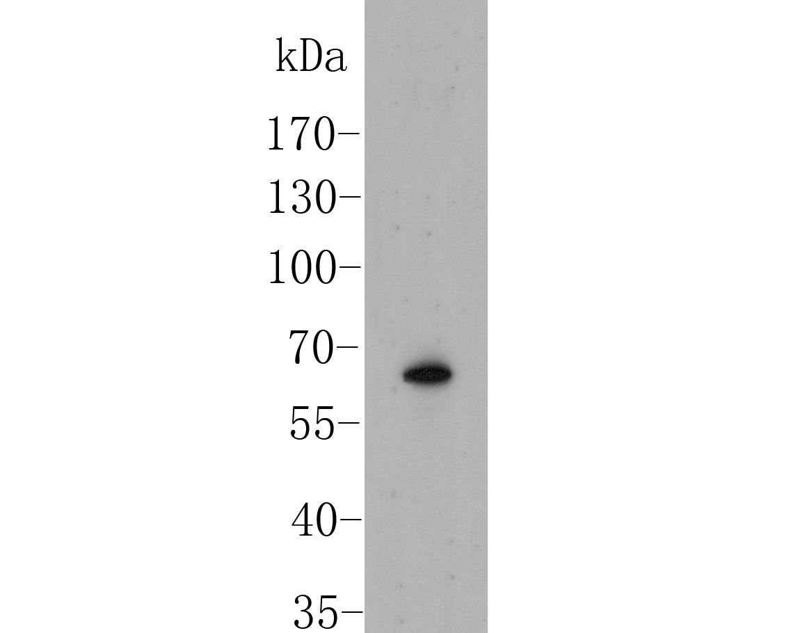 Fig1:; Western blot analysis of SLC8B1 on mouse tonsil tissue lysate. Proteins were transferred to a PVDF membrane and blocked with 5% BSA in PBS for 1 hour at room temperature. The primary antibody ( 1/500) was used in 5% BSA at room temperature for 2 hours. Goat Anti-Rabbit IgG - HRP Secondary Antibody (HA1001) at 1:5,000 dilution was used for 1 hour at room temperature.