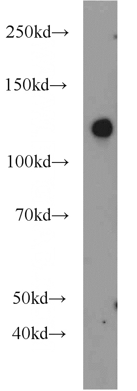 mouse kidney tissue were subjected to SDS PAGE followed by western blot with Catalog No:115586(SRGAP2 antibody) at dilution of 1:1000