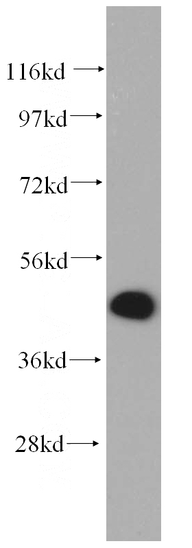 Jurkat cells were subjected to SDS PAGE followed by western blot with Catalog No:115916(TCP10 antibody) at dilution of 1:500