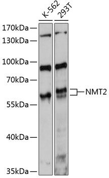 Western blot - NMT2 Polyclonal Antibody 