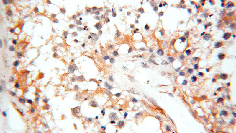 Immunohistochemical of paraffin-embedded human testis using Catalog No:108271(ASS1 antibody) at dilution of 1:100 (under 40x lens)